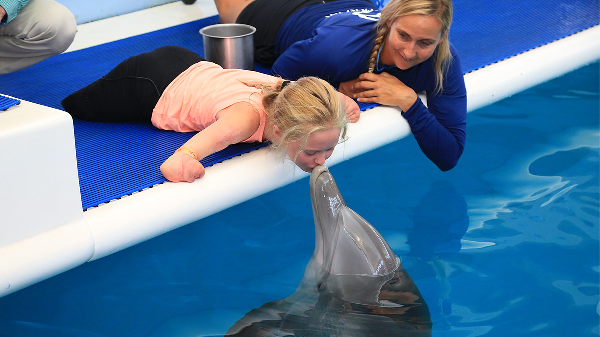 Young quad amputee girl kissing dolphin